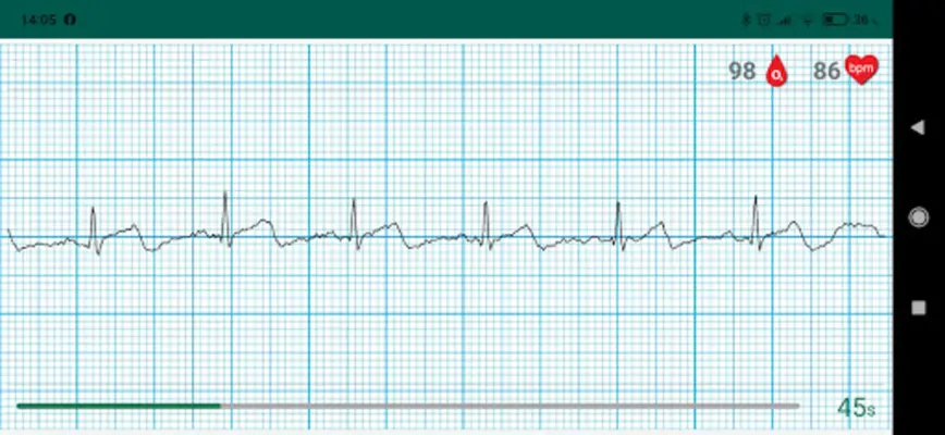 WIWE - ECG diagnostics android App screenshot 14