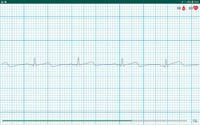 WIWE - ECG diagnostics android App screenshot 6